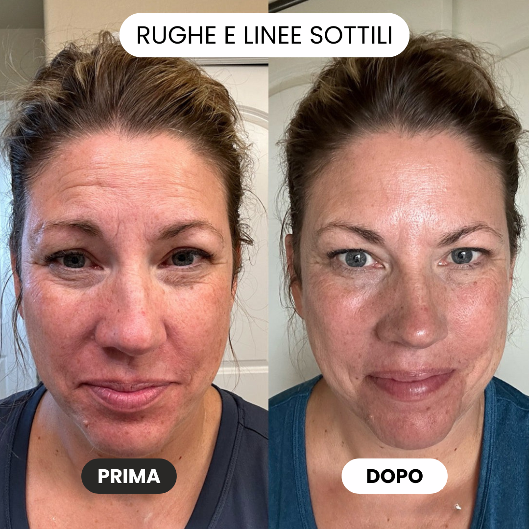 Maschera al collagene per una pelle luminosa
