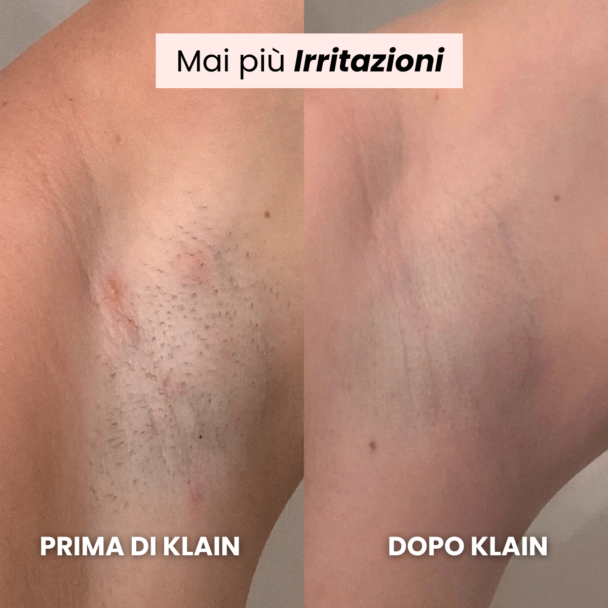 Rasoio KLAIN®
