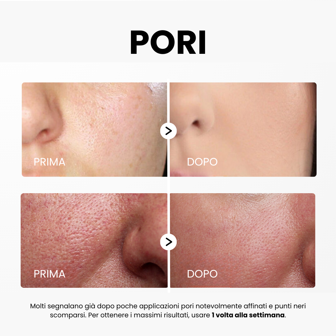 Siero Peel Glow al Riso