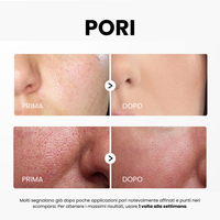 Siero Peel Glow al Riso