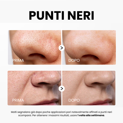 Siero Peel Glow al Riso