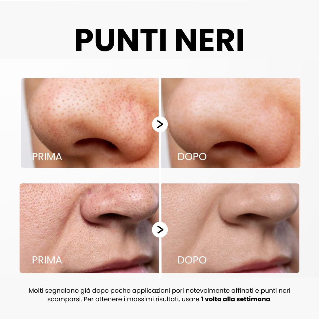 Siero Peel Glow al Riso