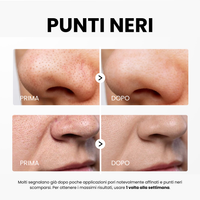 Siero Peel Glow al Riso