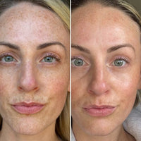 Maschera al collagene per una pelle luminosa