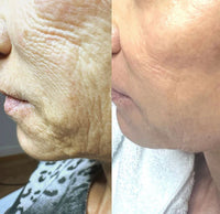 Maschera al collagene per una pelle luminosa