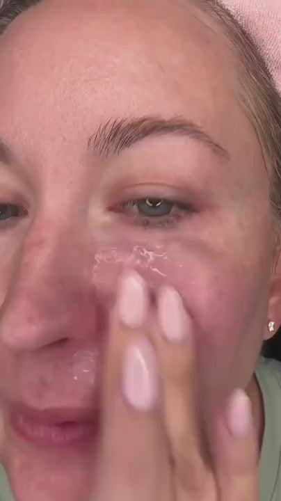 Siero Peel Glow al Riso video